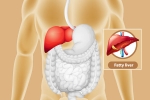 Fatty Liver news, Fatty Liver symptoms, dangers of fatty liver, Oci