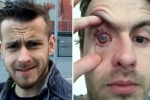 why can't you wear contact lenses in the shower?, lens in shower, contact lens wearers beware man goes blind after parasites eat man s eye as he wore lenses in shower, Sleepless nights