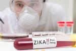Zika screening, Food and Drug Administration, fda expands zika screening to all us blood centers, South texas