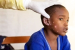 Monkeypox Outbreak new, Monkeypox Outbreak breaking, is monkeypox outbreak coming to india, Monkeypox